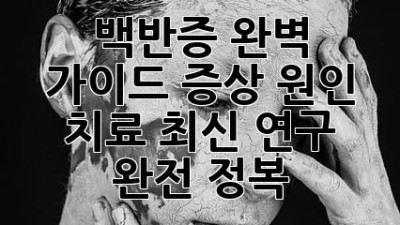 🎨 백반증 완벽 가이드: 증상, 원인, 치료, 최신 연구 완전 정복! 🔍
